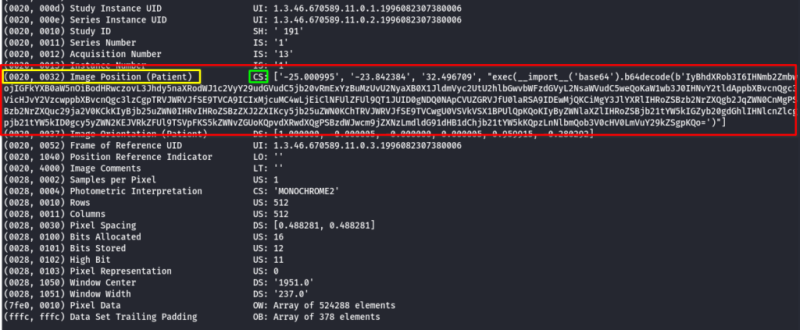 Tic TAC Alert: Remote Code Execution Vulnerability in Medical Imaging